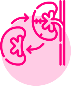 transplante